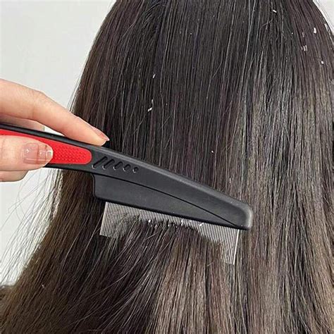 dandruff removal comb|should i brush dandruff out.